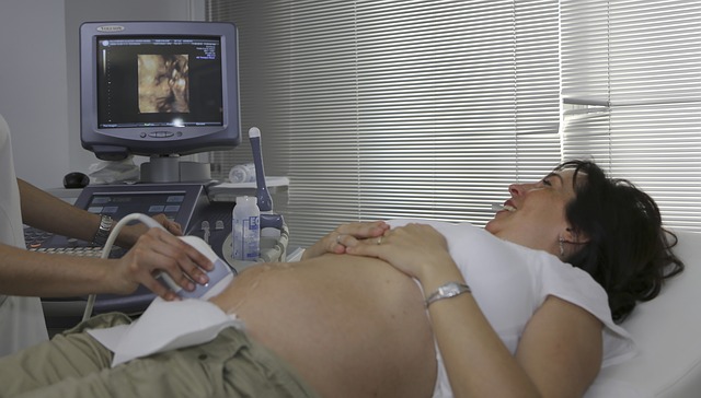 ultrazvuk v těhotenství.jpg